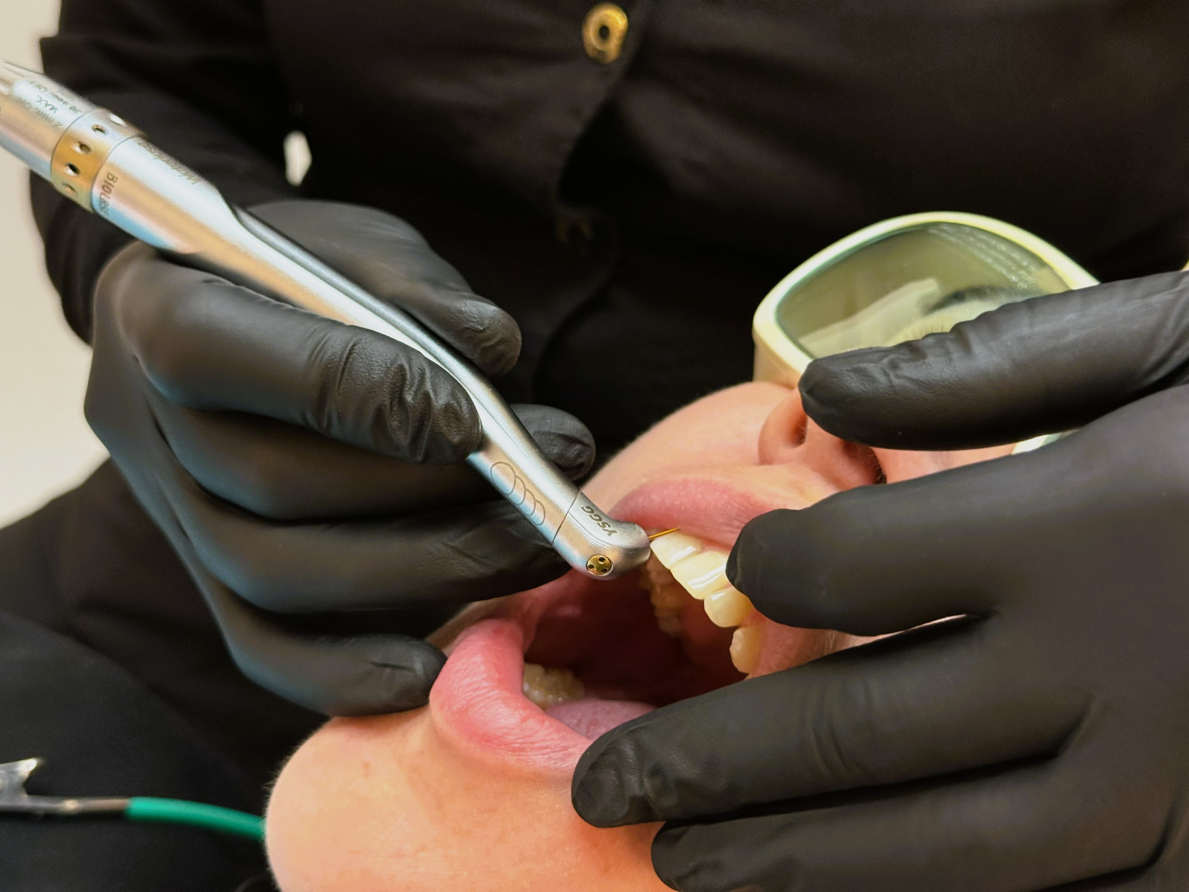 Precision Dental Restoration